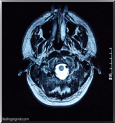 brain scan