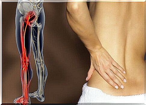 How to treat sciatica and low back pain?