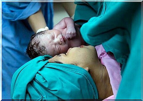 Taking care of yourself after a caesarean section